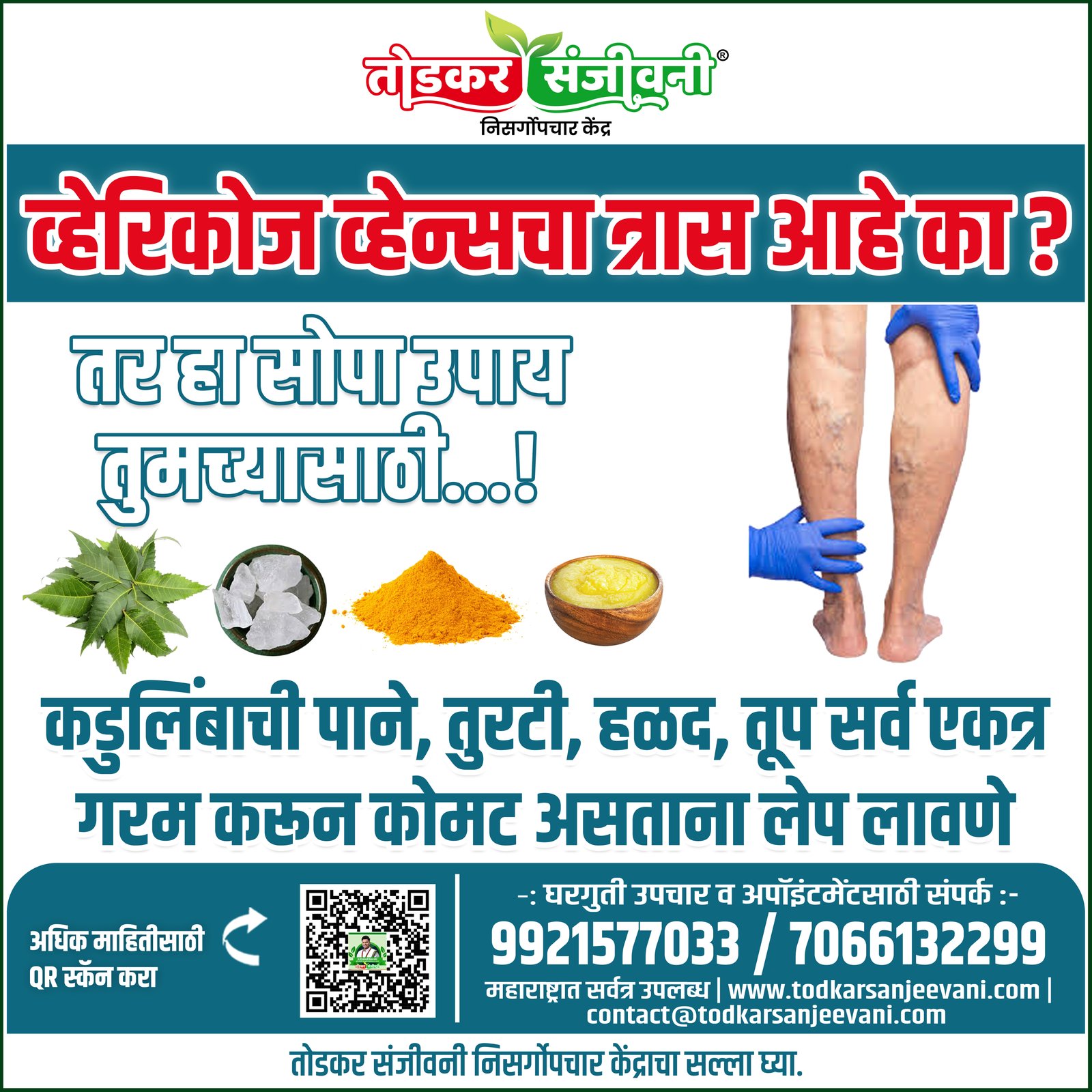 Varicose Veins